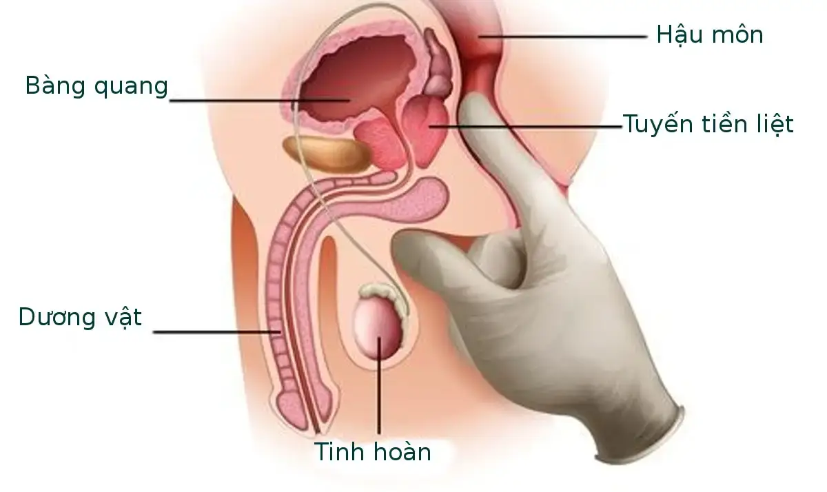 Tuyến tiền liệt nam giới