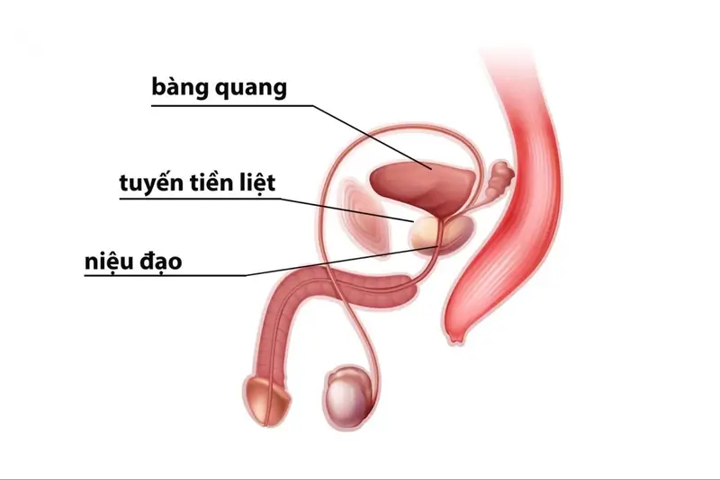 Viêm tuyến tiền liệt - Bệnh lý hay gặp ở nam giới